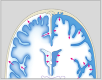 Cerebrospinal fluid (CSF)