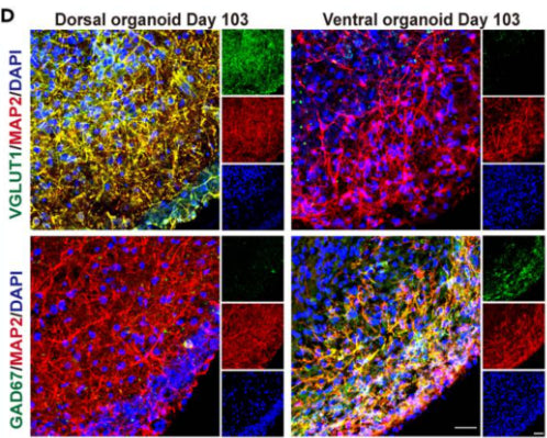 Images of dorsal and ventral forebrain organoids immunostained for VGlut1 (cat. 75-066, 1:250) and GAD67. Image from publication CC-BY-4.0. PMID:38390494