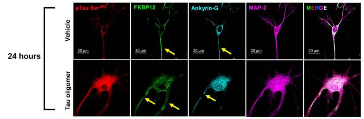 Representative images showed the high expression level of FKBP12 (green) in axonal hillock/axon initial segment (labeled by anti–ankyrin-G antibody, cat. 75-147; bright blue) under basal conditions whereas FKBP12 translocated to soma and dendrites when neurons bear tau aggregation. Image from publication CC-BY-4.0. PMID:36724228
