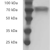 Fig.SDS-PAGE analysis of Human CD30/TNFRSF8 protei