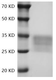 Fig.SDS-PAGE analysis of Human CD7/GP40 protein