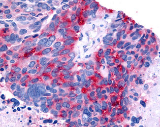 IHC - RORB / ROR Beta Antibody (Ligand-binding Domain) ALS10547