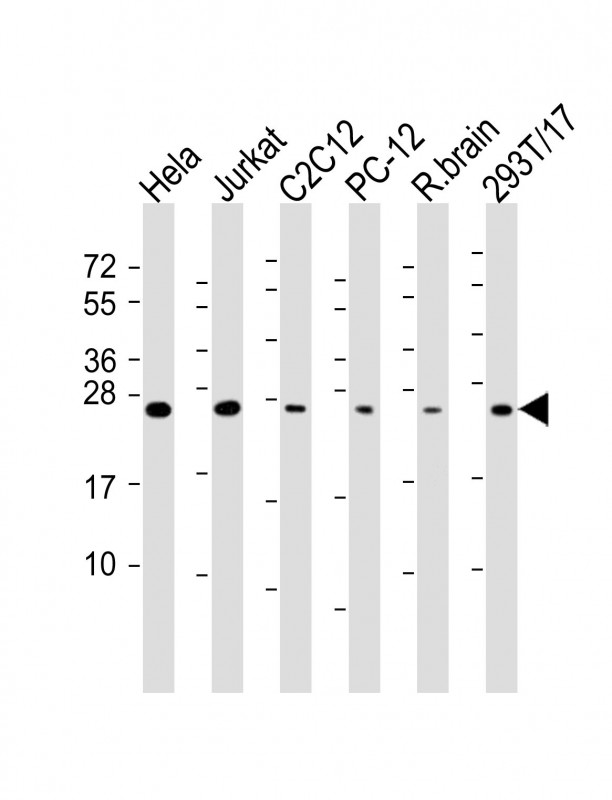 WB - RAB11A Antibody AM8496b