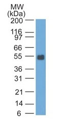 WB -  Ep-CAM / CD326 (Rat) (Epithelial Marker) Antibody - Bioreactor Concentrate  AH10975-01