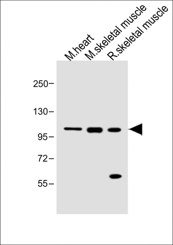 WB - Mouse Csf1r Antibody (C-term) AP13911b