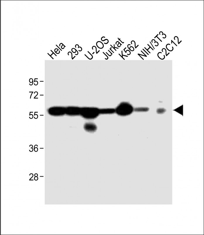 WB - Vimentin Antibody AX10005