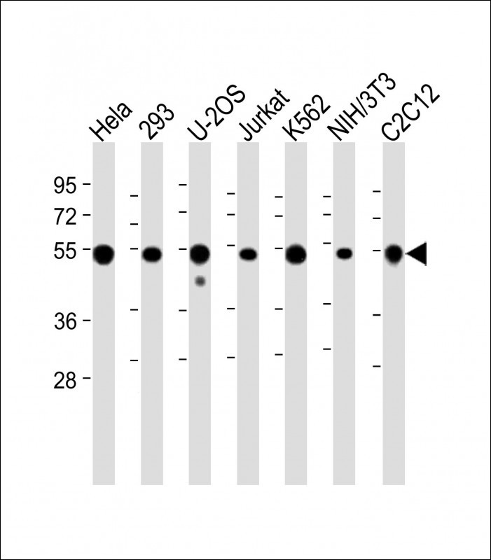 WB - Vimentin Antibody AX10005