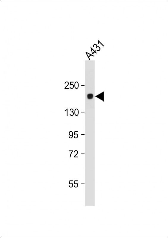 WB - PRDM10 Antibody AM1193a