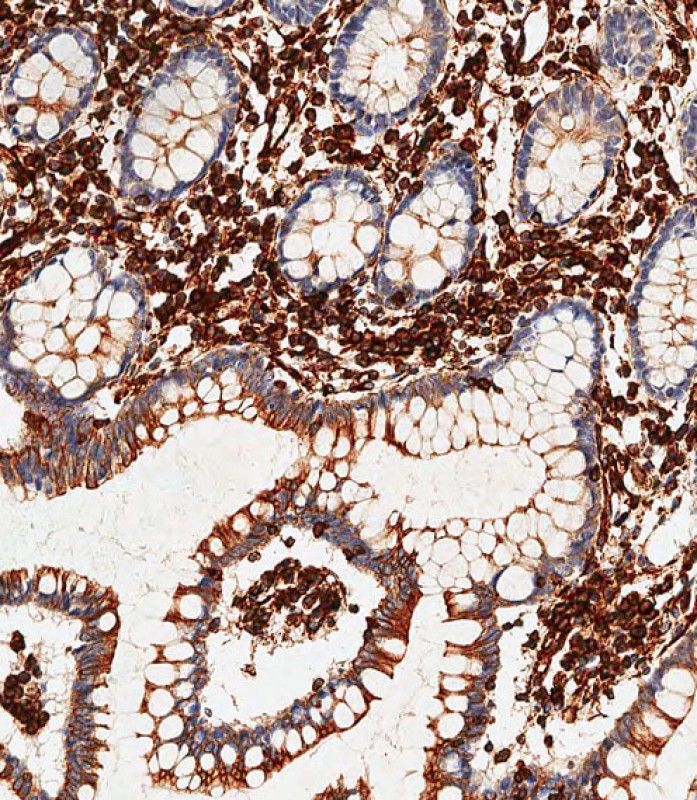 IHC-P-Leica - Vimentin Antibody AX10005