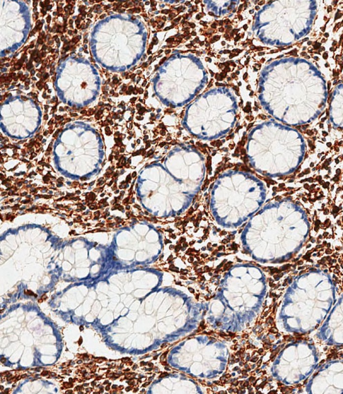 IHC-P-Leica - Vimentin Antibody AX10005