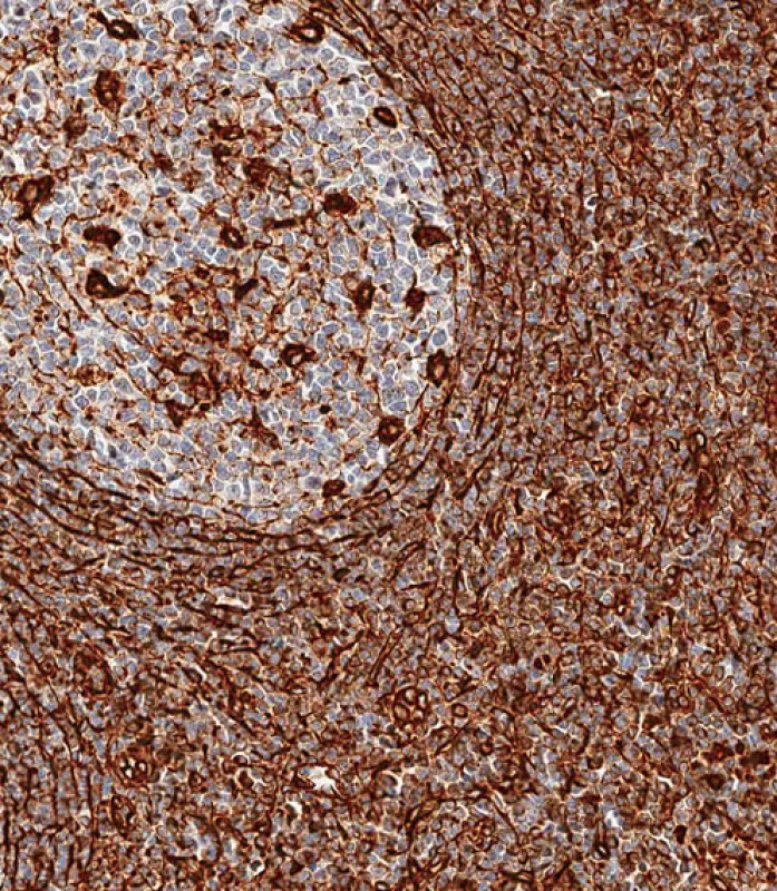 IHC-P-Leica - Vimentin Antibody AX10005