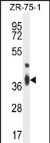 WB - TMBIM4 Antibody (N-term) AP10496a