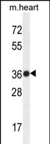 WB - TMBIM4 Antibody (N-term) AP10496a