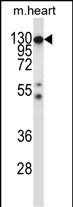 WB - Mouse Csf1r Antibody (C-term) AP13911b