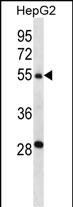 WB - TMPRSS13 Antibody (C-term) AP14675b