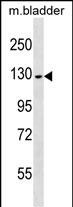 WB - PRDM10 Antibody (Center) AP17394c