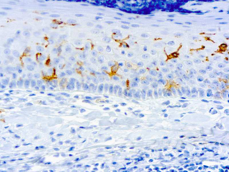 IHC - CD1A CORTICAL THYMOCYTES ADB1275-1