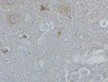 ADRB3 staining in rat brain. Formalin-fixed paraffin-embedded rat brain is stained with ADRB3 Antibody (Cat. No. 251434) used at 1:200 dilution.