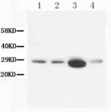 The Calbindin-D Antibody (Cat. No. 251714) is used in Western blot to detect Calbindin-D in rat brain (1, 2), kidney (3) and lung (4) tissue lysates.