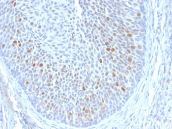 Anti-HPV16 E1/E4 (Human Papilloma Virus 16) Monoclonal Antibody(Clone: HPV16 E1/E4)
