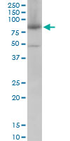 Western Blot (Cell lysate)