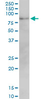 Western Blot (Cell lysate)