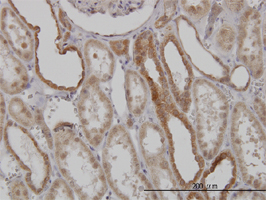 Immunohistochemistry (Formalin/PFA-fixed paraffin-embedded sections)