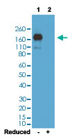 Western Blot