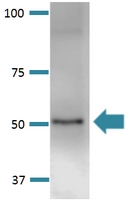 Western Blot (Tissue lysate)