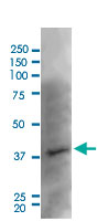 Western Blot (Tissue lysate)