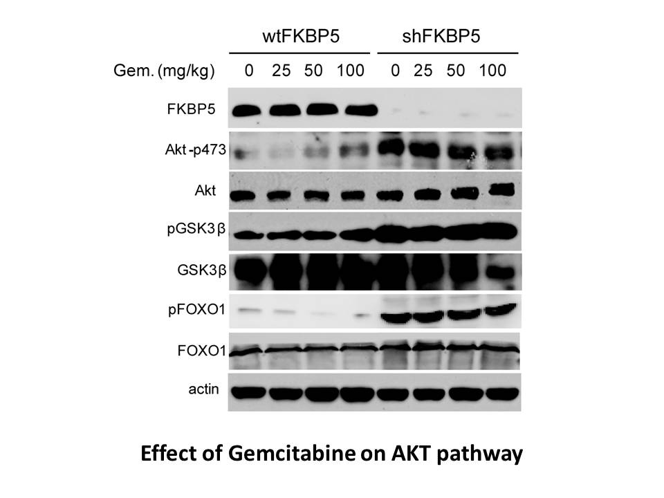 Gemcitabine