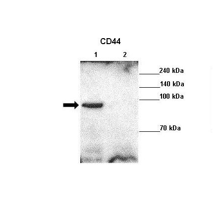 Human MDA-MB231