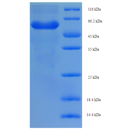 Protein SDS-PAGE