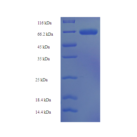 Protein SDS-PAGE