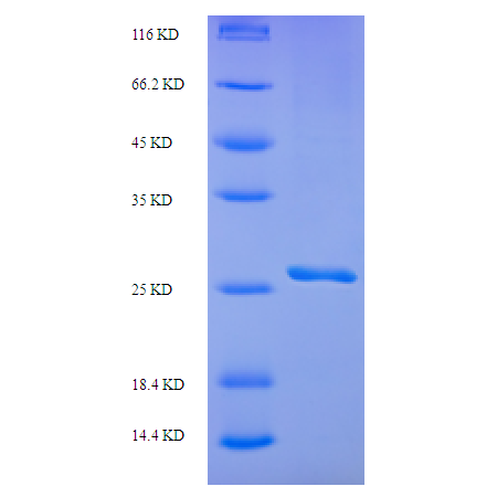 Protein SDS-PAGE