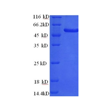 Protein SDS-PAGE