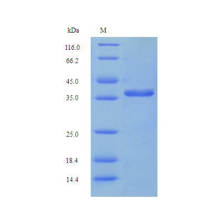 Protein SDS-PAGE