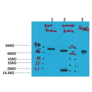 Western Blot