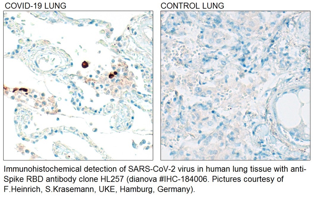 Immunohistochemistry Anti SARS-CoV-2 Antibody Spike RBD IHC-184006 (Klon HL257 )