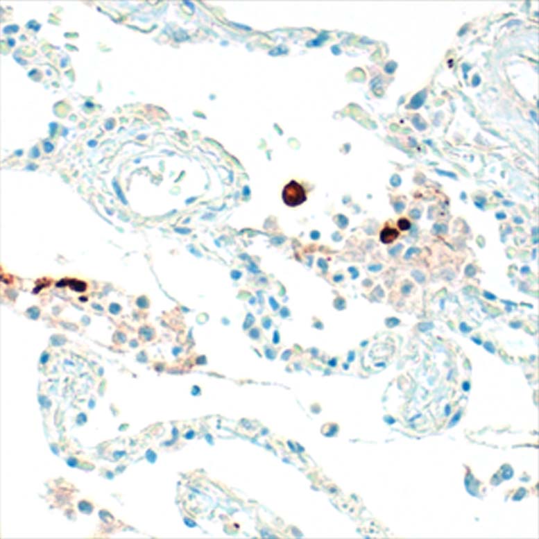 Immunohistochemistry Anti SARS-CoV-2 Antibody Spike RBD IHC-184006 (Klon HL257 )