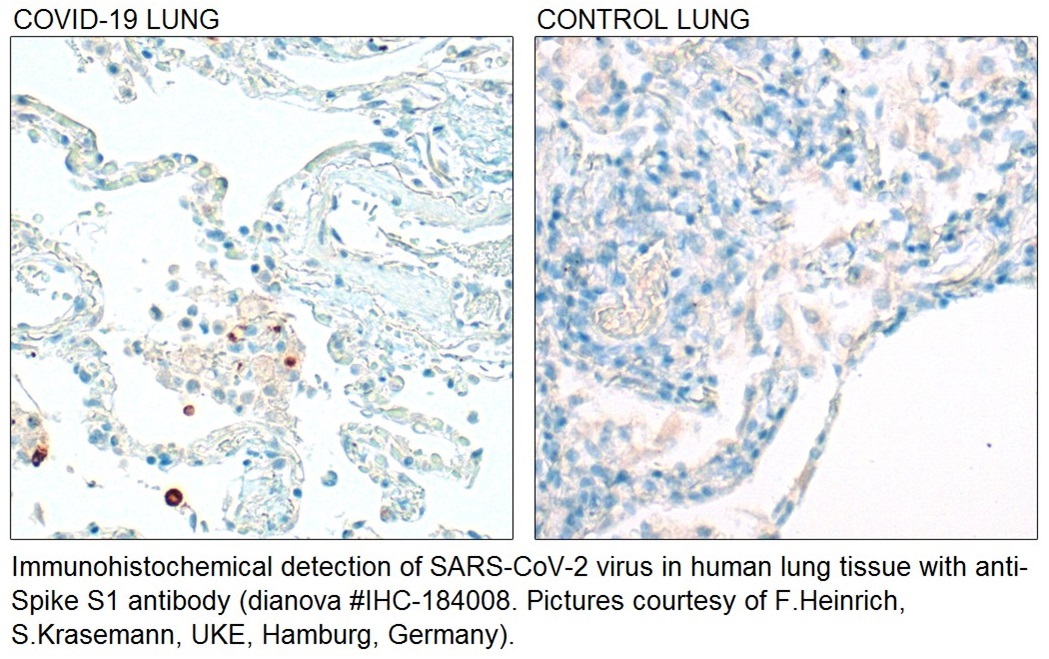 Immunohistochemistry Anti SARS-CoV-2 Antibodyr S1 IHC-184008 (polyklonal)