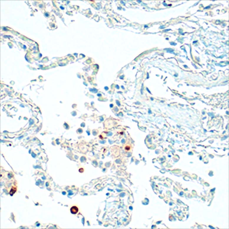 Immunohistochemistry Anti SARS-CoV-2 Antibodyr S1 IHC-184008 (polyklonal)