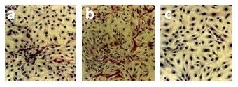 00982_Abb3_Thyrocyte-culture-before-and-after-elimination-of-fibroblasts-with-anti-CD90-DIA-100