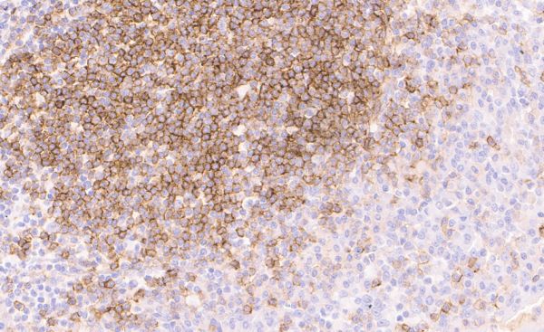 CD73 immunohistochemistry in a tonsil.