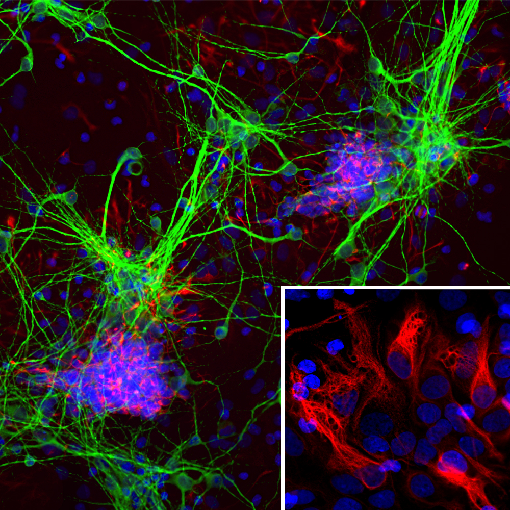 Immunofluorescence Nestin