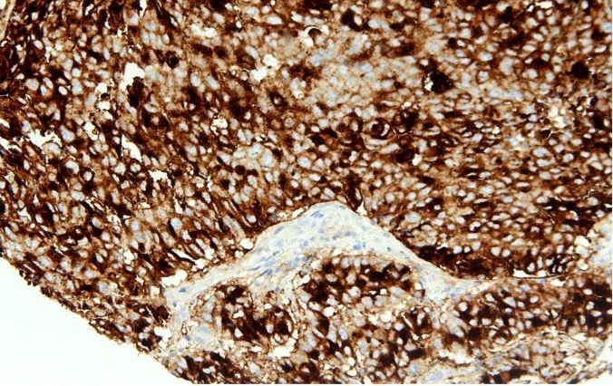 Immunohistochemistry 1