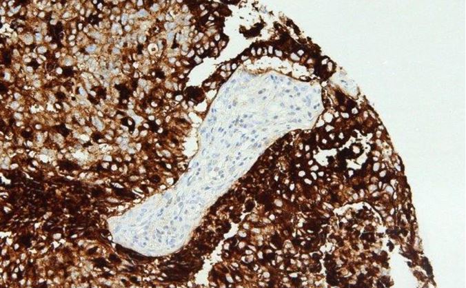 Immunohistochemistry 2