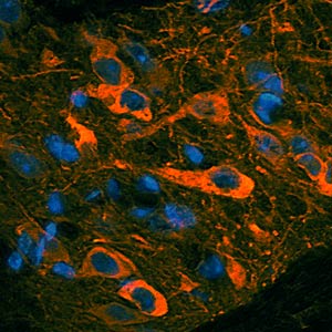 Immunohistochemistry