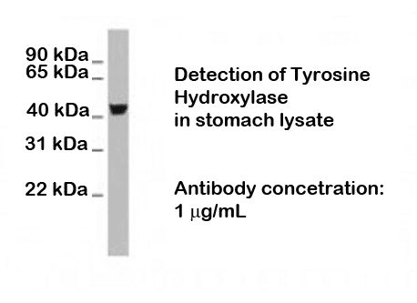 Western Blot