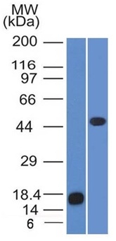 Western Blot of recombinant Adipophilin and Jurkat cell lysate using Adipophilin Mouse Monoclonal Antibody (ADFP/1365).